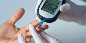 Чихрийн шижингийн өвчлөл нэмэгдэж байна