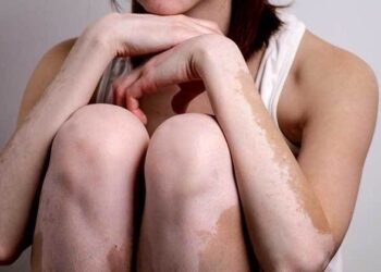 Арьс цайх өвчний цаана амьдралаас тусгаарлагдах аюул нуугддаг