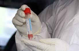 Улаанбаатар хотод дархлаажуулалтын суурин 39 цэг ажиллана