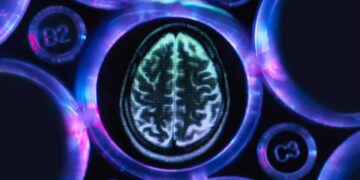 Настай хүмүүс их унтах нь альцгеймерийн өвчнийг таних анхны шинж тэмдэг