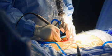 Хугарлыг хадаасаар бэхлэх, уушги оёх, тайрах зэрэг мэс заслыг орон нутагт хийж байна