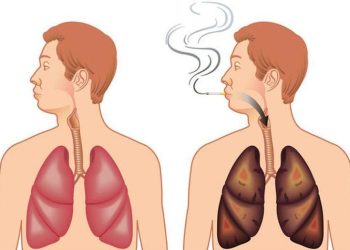 Сүрьеэг оношлохын тулд хиймэл оюунаар рентген зураг уншиж эхэлжээ