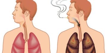 Сүрьеэг оношлохын тулд хиймэл оюунаар рентген зураг уншиж эхэлжээ