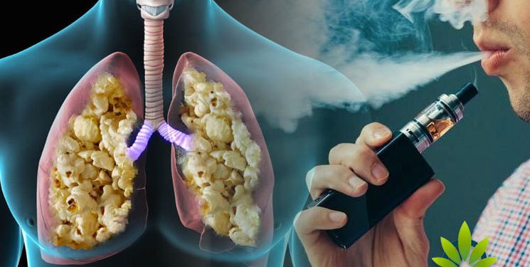 Судалгаа: Сурагчид электрон тамхи татах нь цаг үеэ дагасан, загварлаг гэж хариулжээ