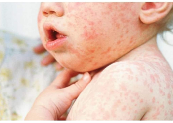 Улаанбурханаар өвдсөн хоёр хүүхэд нас баржээ