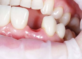 Шинэ шүд ургуулах эмчилгээг 2030 оноос эмчилгээнд нэвтрүүлнэ